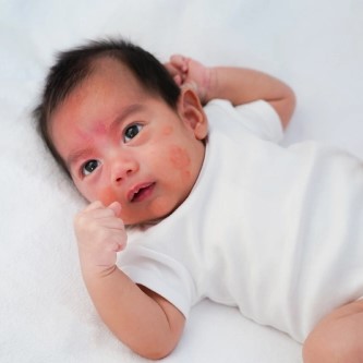 Cara mengatasi batuk pada bayi - Nutriclub.
