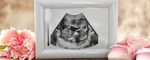 Perkembangan Janin pada Trimester Pertama