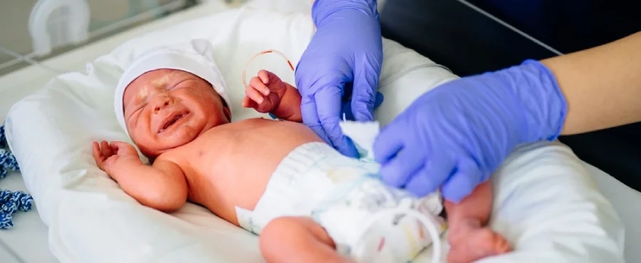 perawatan bayi prematur di nicu-nutriclub
