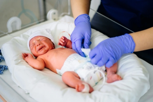 Banner Artikel Penanganan Bayi Prematur di NICU dan Syarat Pulang
