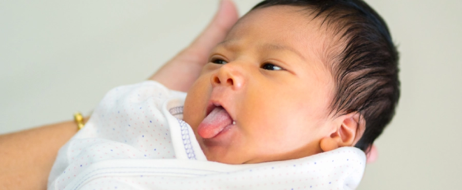 Banner Artikel Penyebab Lidah Bayi Putih dan Cara Mengatasinya dengan Aman