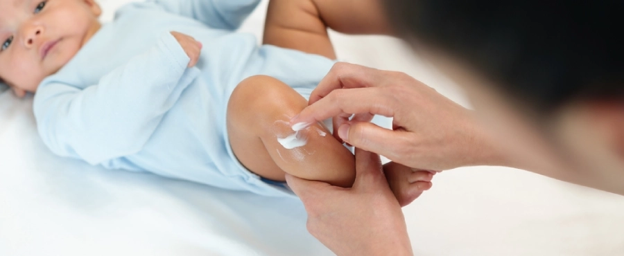 Banner Artikel Cara Mencegah Alergi pada Bayi Sejak Dini agar Tidak Mudah Alergian Banner Artikel Cara Mencegah Alergi pada Bayi Sejak Dini agar Tidak Mudah Alergian