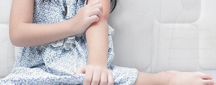 Macam-Macam Alergi pada Anak dan Cara Mengatasinya