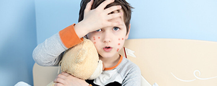 Penyakit Alergi pada Awal Kehidupan Bayi