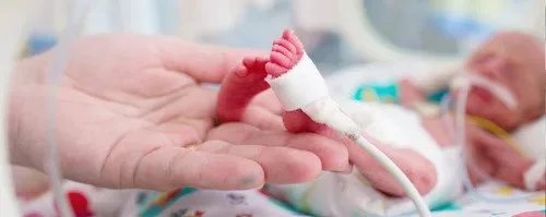 Inilah Perhitungan Usia Bayi Prematur dan Tahap Perkembangannya