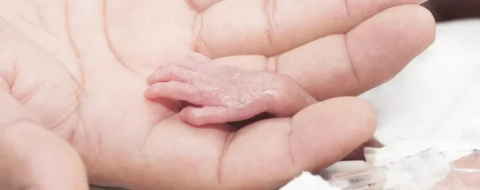 Penanganan Bayi Prematur di NICU dan Peran Orang Tua