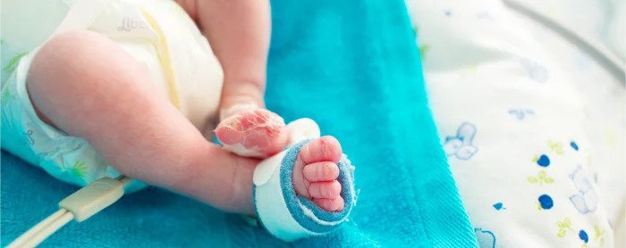 Penyebab Kelahiran Prematur dan Risiko Komplikasinya