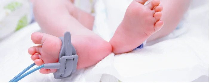 Mari Ketahui Pentingnya Skrining Bagi Bayi Prematur