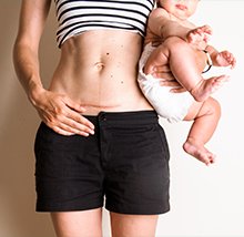 Banner Artikel Kenali Risiko Melahirkan Caesar Bagi Ibu dan Bayi
